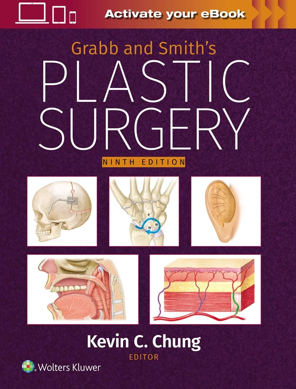 Grabb and Smith's Plastic Surgery: Print + eBook with Multimedia: eBook without Multimedia