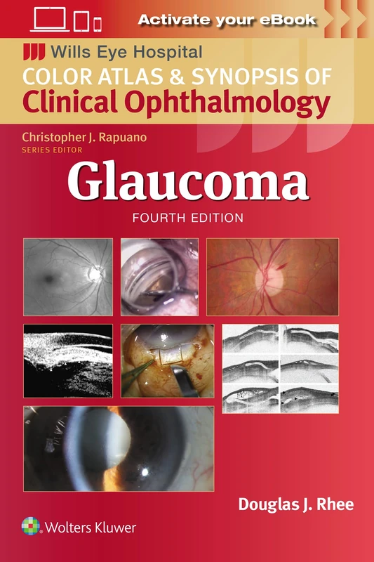 Glaucoma: Wills Eye Institute Atlas Series