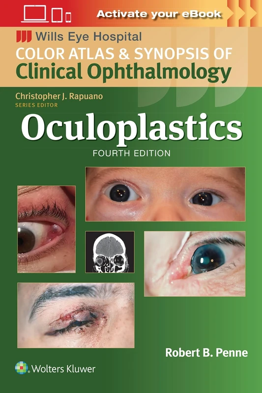 Oculoplastics: Wills Eye Institute Atlas Series