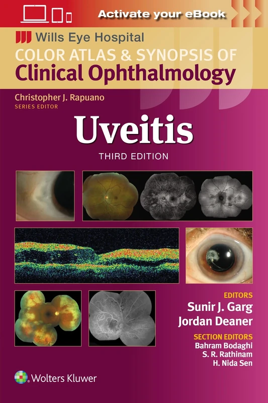 Uveitis: Wills Eye Institute Atlas Series