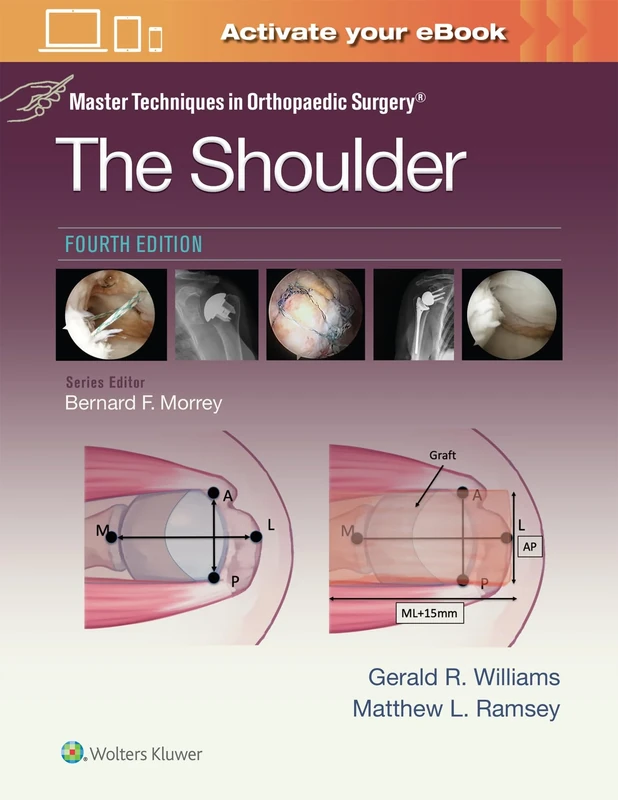 Master Techniques in Orthopaedic Surgery: The Shoulder: Print + eBook with Multimedia: The Shoulder: eBook with Multimedia