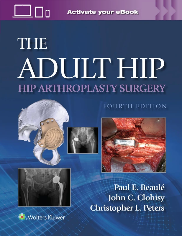 Lippincott Williams & Wilkins - The Adult Hip Print and eBook