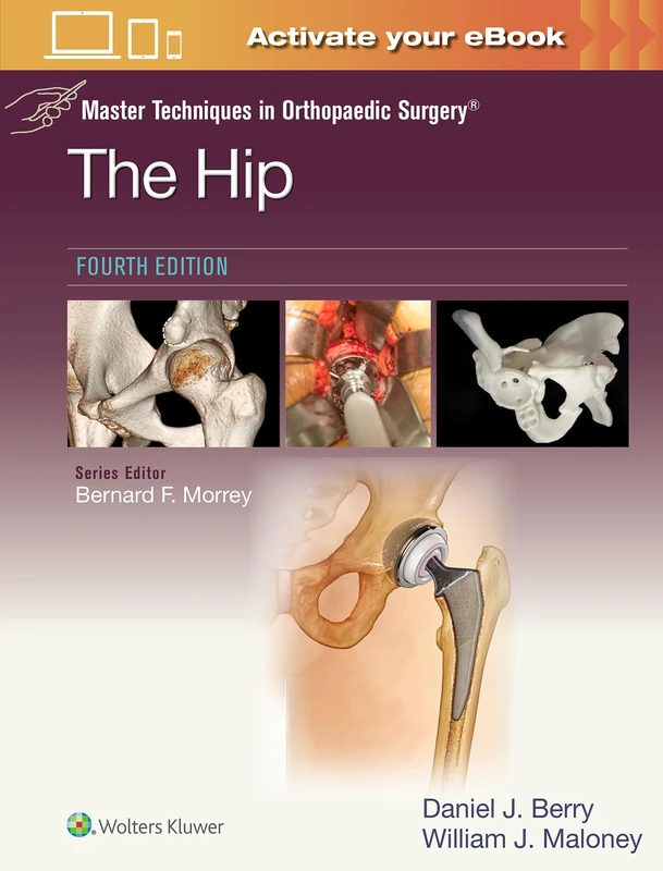 Master Techniques in Orthopaedic Surgery: The Hip: Print + eBook with Multimedia