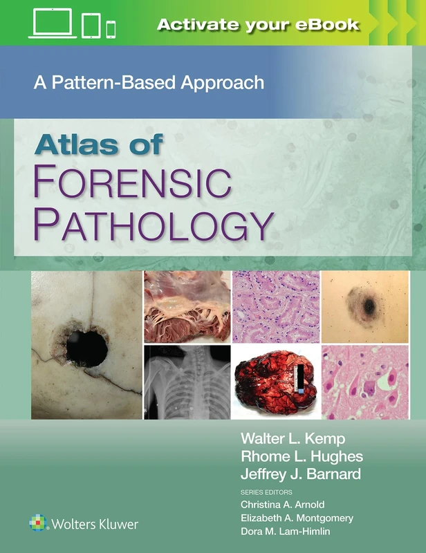 Atlas of Forensic Pathology: A Pattern Based Approach: Print + eBook with Multimedia: A Pattern Based Approach: eBook with Multimedia