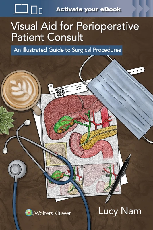 Visual Aid for Perioperative Patient Consult: An Illustrated Guide to Surgical Procedures - Image 1