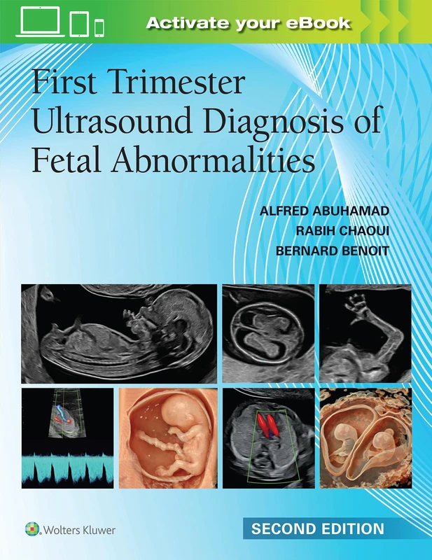 First Trimester Ultrasound Diagnosis of Fetal Abnormalities