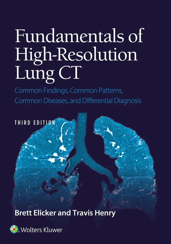 Fundamentals of High-Resolution Lung CT: Common Findings, Common Patterns, Common Diseases, and Differential Diagnosis