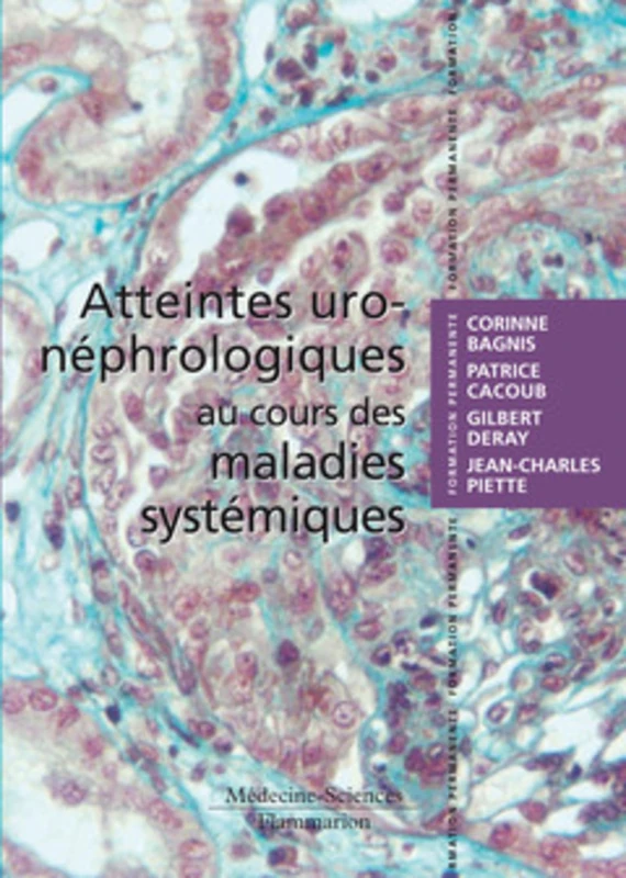 Atteintes uro-néphrologiques au cours des maladies systémiques
