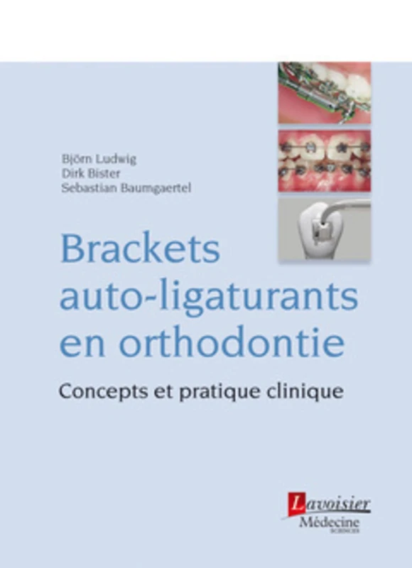 Brackets auto-ligaturants en orthodontie: Concepts et pratique clinique