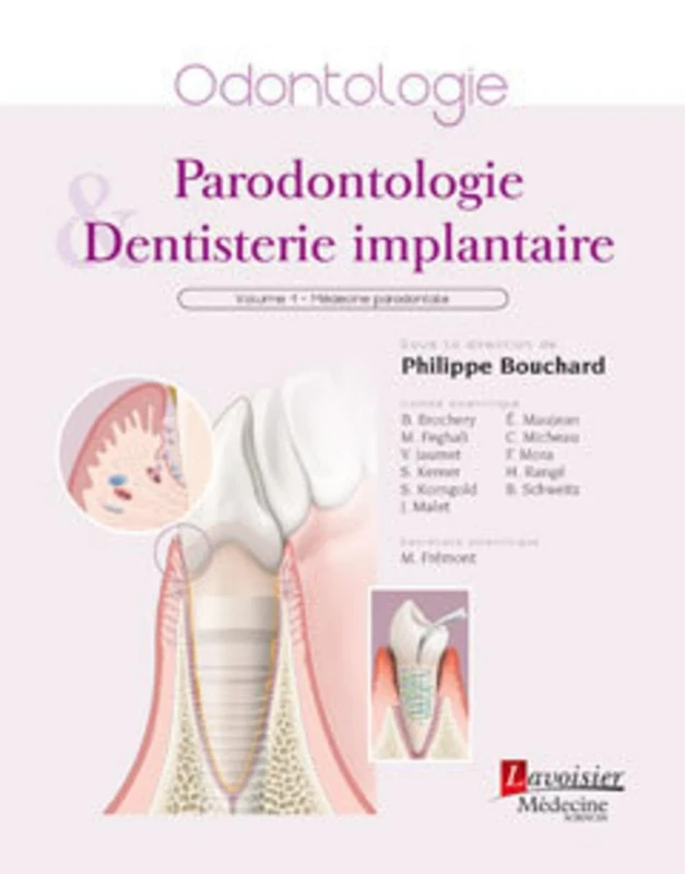Parodontologie et Dentisterie implantaire. Volume 1 : Médecine parodontale: Volume 1 : Médecine parodontale - Image 1
