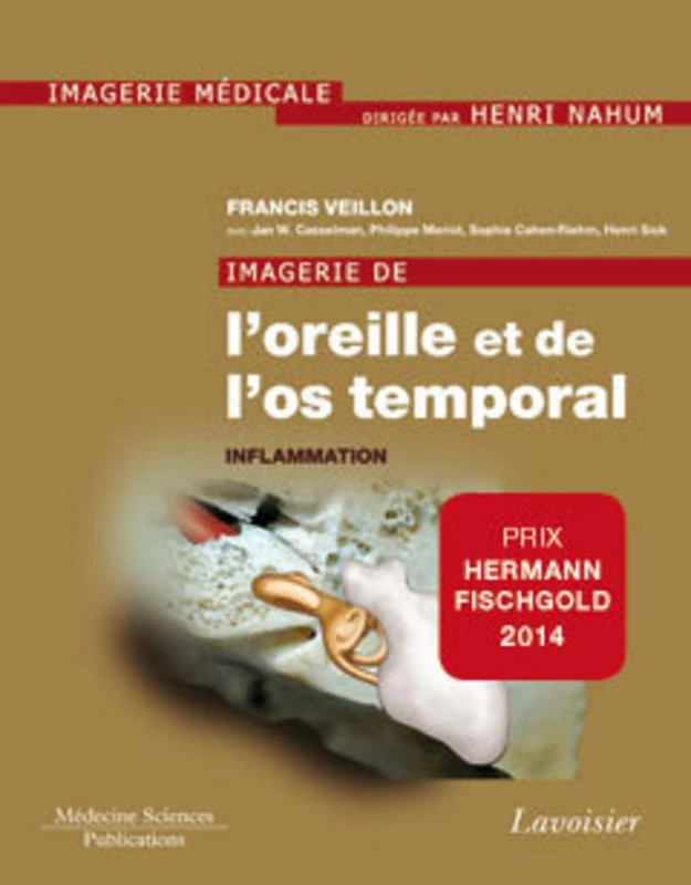 Imagerie de l'oreille et de l'os temporal - Volume 2. Inflammation: Volume 2. Inflammation