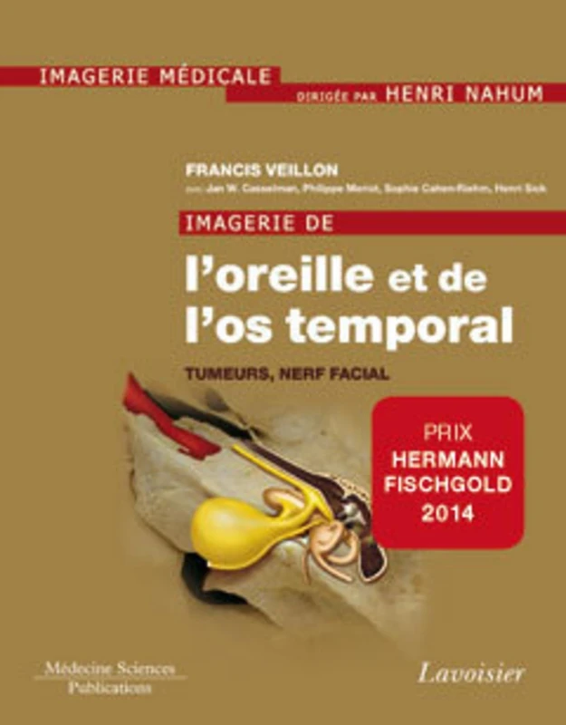 Imagerie de l'oreille et de l'os temporal - Volume 4. Tumeurs, nerf facial: Volume 4. Tumeurs, nerf facial - Image 1