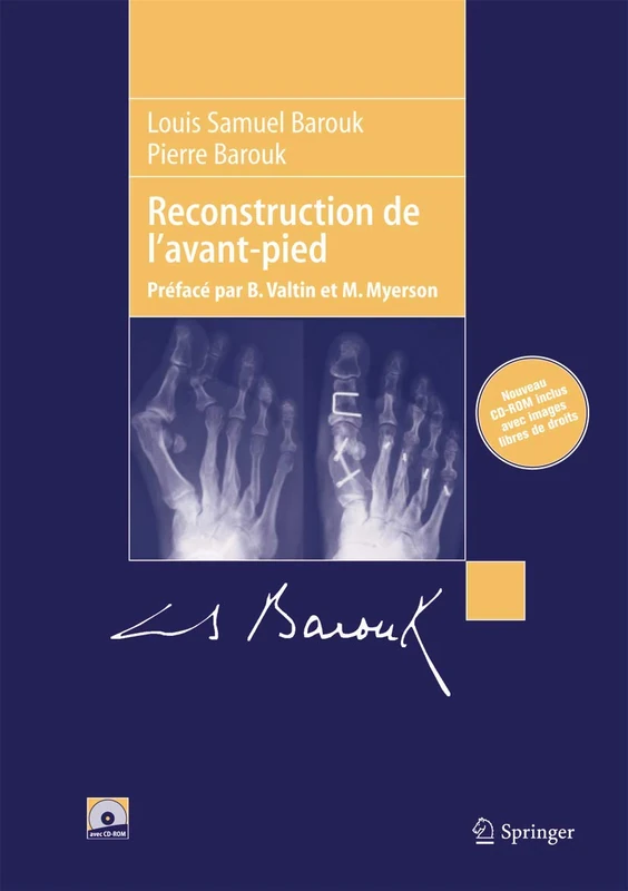 Reconstruction De L'Avant-Pied
