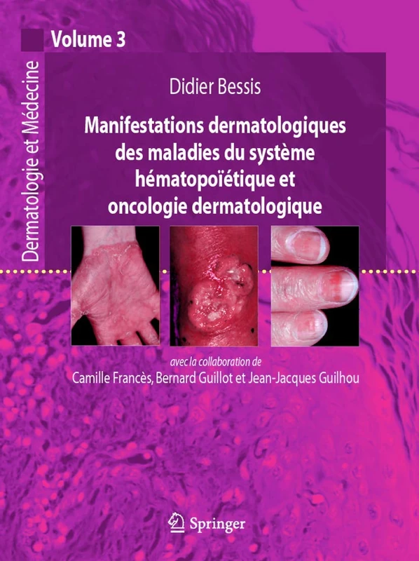 Manifestations Dermatologiques Des Maladies Du Systeme Hematopoietique Et Oncologie Dermatologique: Dermatologie Et Medecine: Dermatologie et médecine, vol. 3