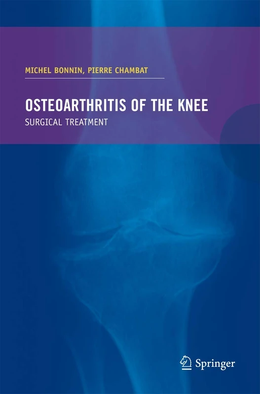 Osteoarthritis of the knee - Image 1