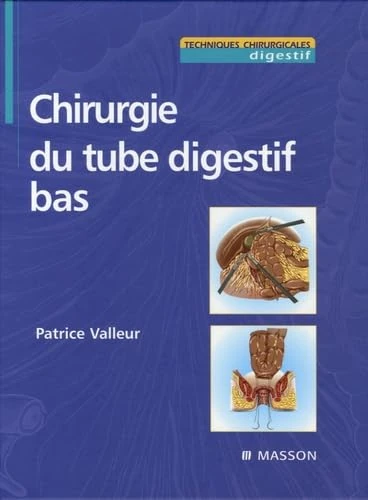 Chirurgie du tube digestif bas
