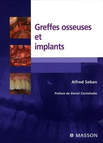 Greffes osseuses et implants