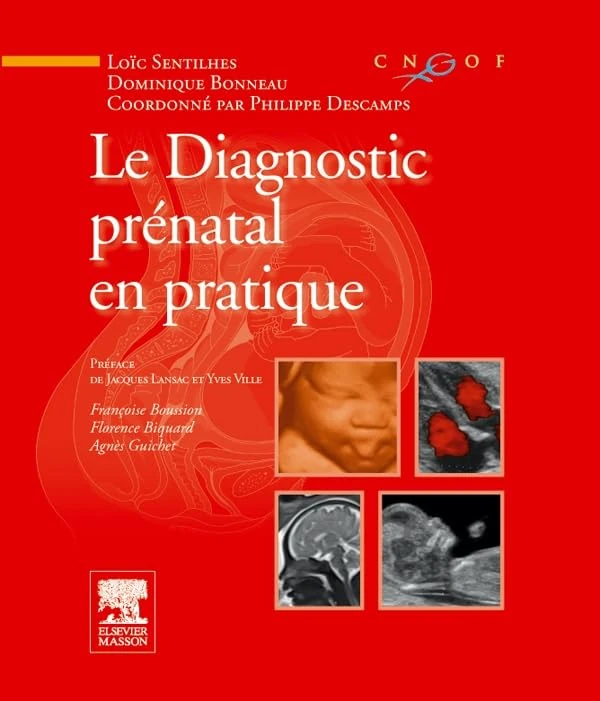 Elsevier Masson - Le diagnostic prenatal en pratique