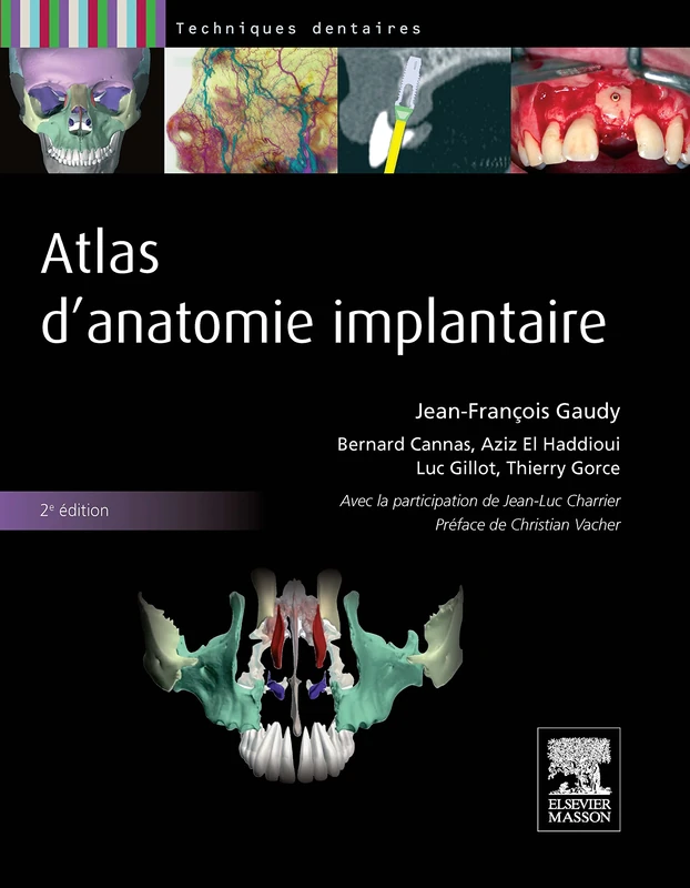 Atlas d'anatomie implantaire: Pilon Partiel 400ex 19/12/14 - Image 1