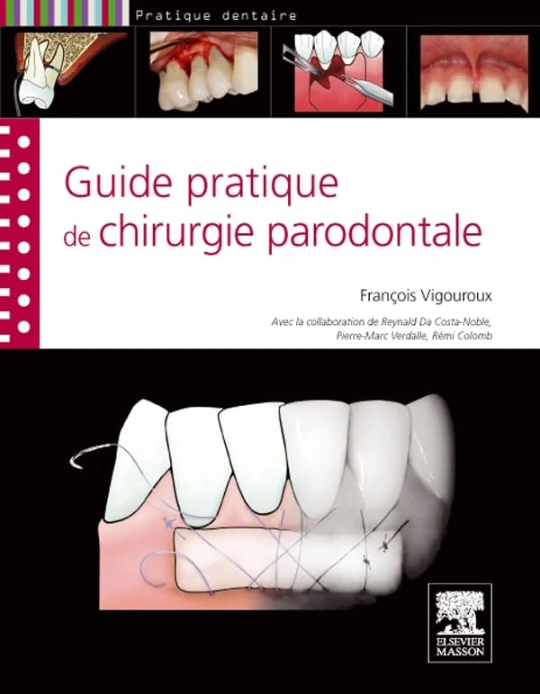 Guide pratique de chirurgie parodontale - Image 1