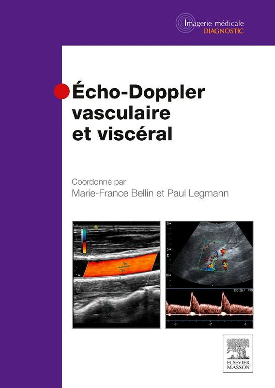 Echo-doppler Vasculaire Et Viscéral