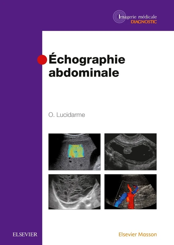 Echographie Abdominale (Imagerie Medicale Diagnostic)
