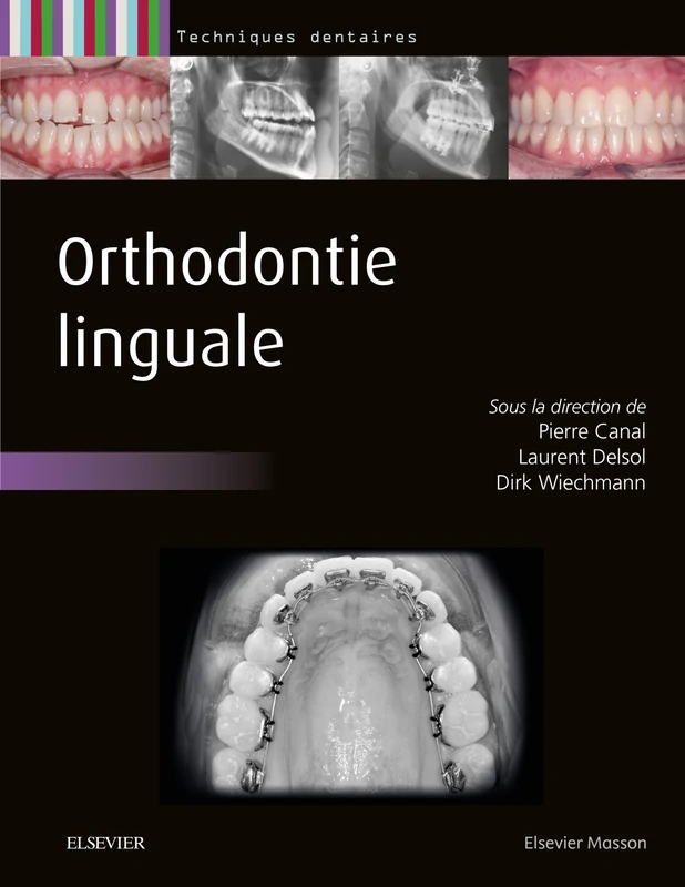 Elsevier Masson Orthodontie linguale - Dentistry Book