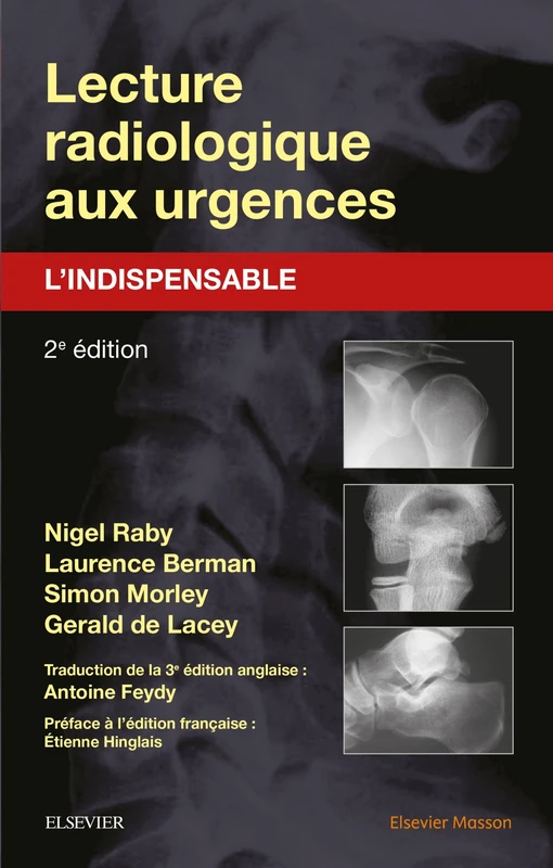 Lecture Radiologique Aux Urgences: L'indispensable