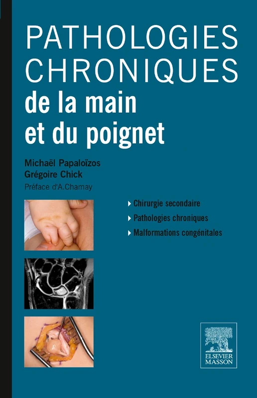 Pathologies Chroniques Main Et Poignet: Tome 2