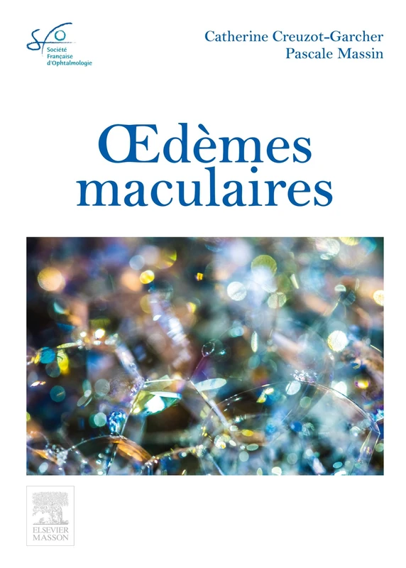 Oedèmes Maculaires: Rapport Sfo - Image 1