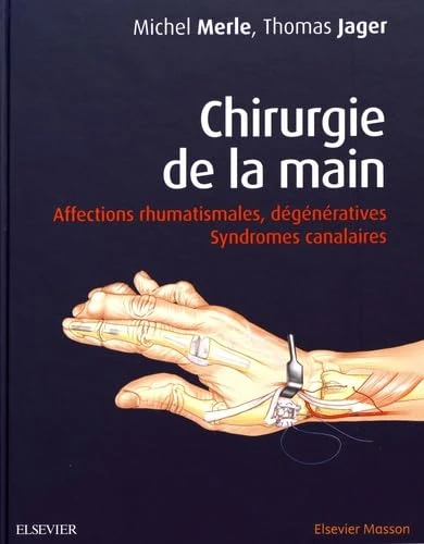 Chirurgie de la main: Affections rhumatismales, dégénératives. Syndromes canalaires