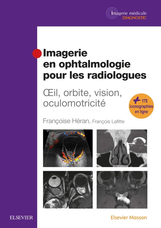 Imagerie en ophtalmologie pour les radiologues: Oeil, orbite, vision, oculomotricité