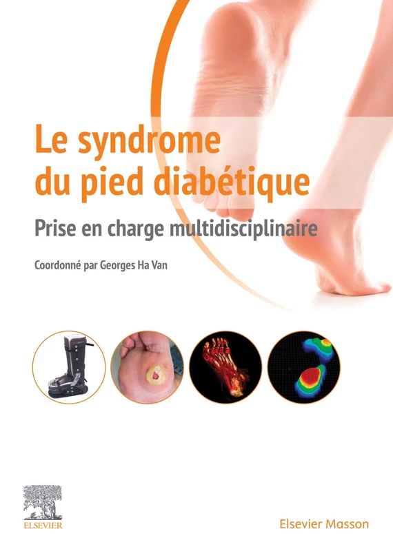 Le syndrome du pied diabétique: Prise en charge multidisciplinaire