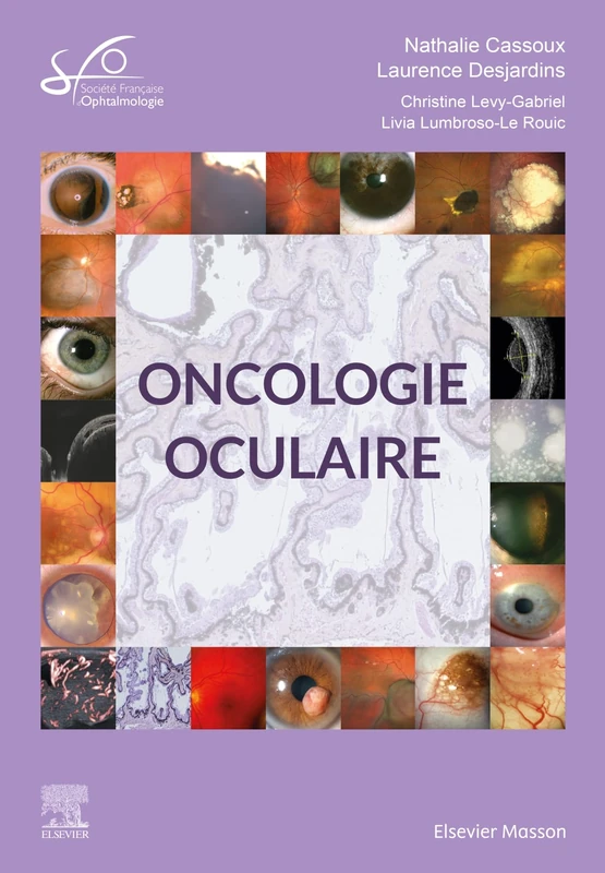 Oncologie oculaire: Rapport SFO 2022