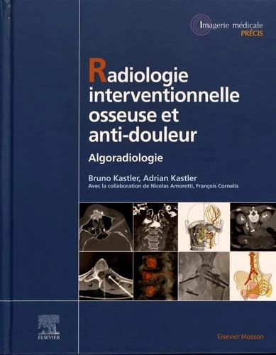 Radiologie Interventionnelle osseuse et anti-douleur: Algoradiologie