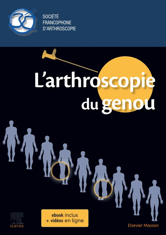 L'arthroscopie du genou - Image 1