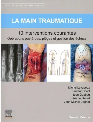 La main traumatique 10 interventions courantes: Manuel de chirurgie du membre supérieur