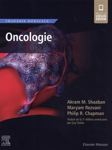 Imagerie médicale : Oncologie: Oncologie