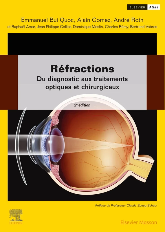 Réfractions: Du diagnostic aux traitements optiques et chirurgicaux - Image 1