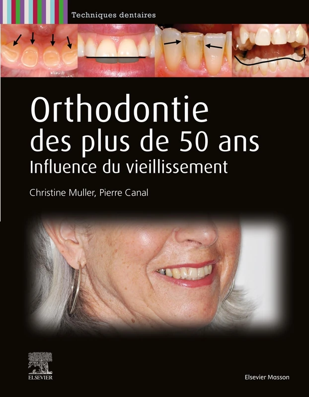 Orthodontie des plus de 50 ans: Influence du vieillissement