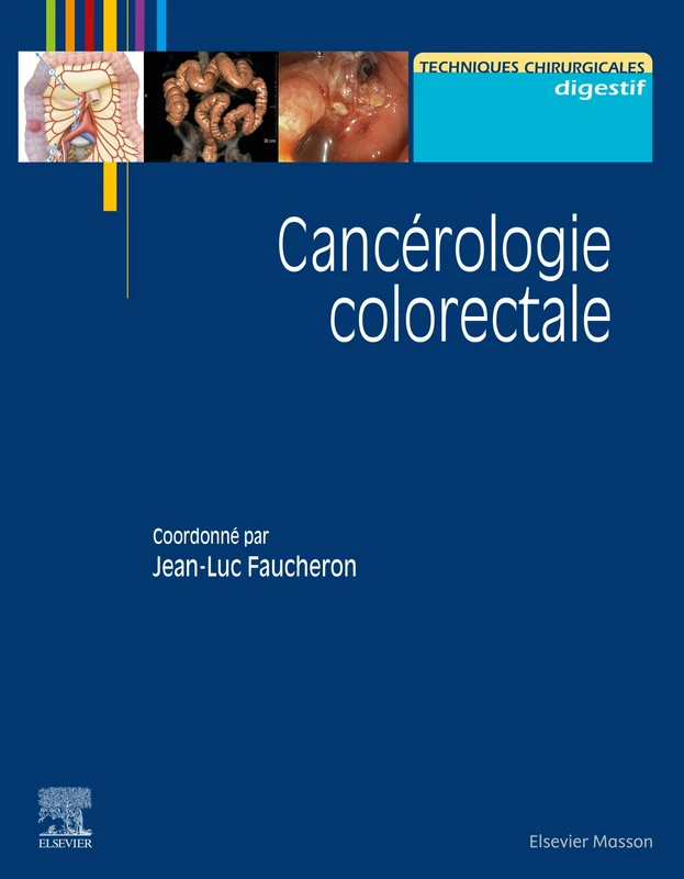 Cancérologie colorectale - Image 1