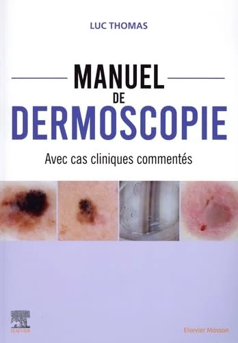 Manuel de dermoscopie: Avec cas cliniques commentés