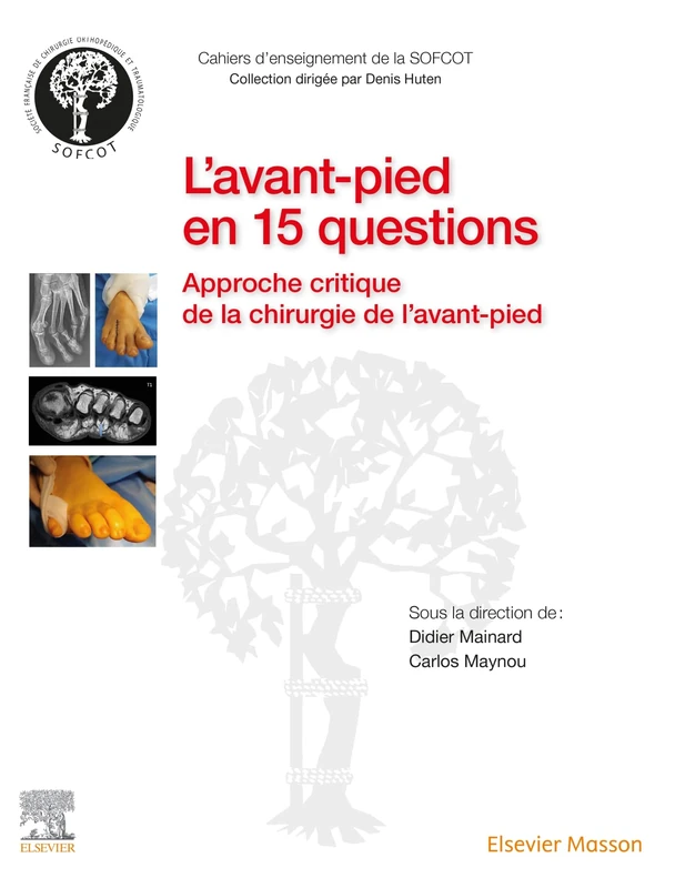 L'avant-pied en 15 questions: Approche critique de la chirurgie de l'avant-pied - Image 1