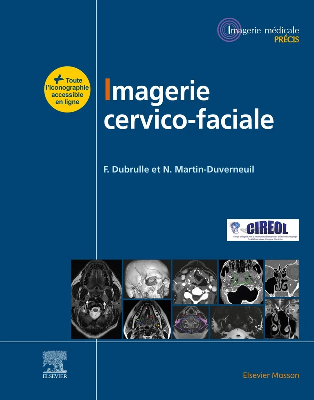 Imagerie cervicofaciale: Massif facial - Sinus - Voies aérodigestives supérieures - Pathologies cervicales - Espaces profonds de la face