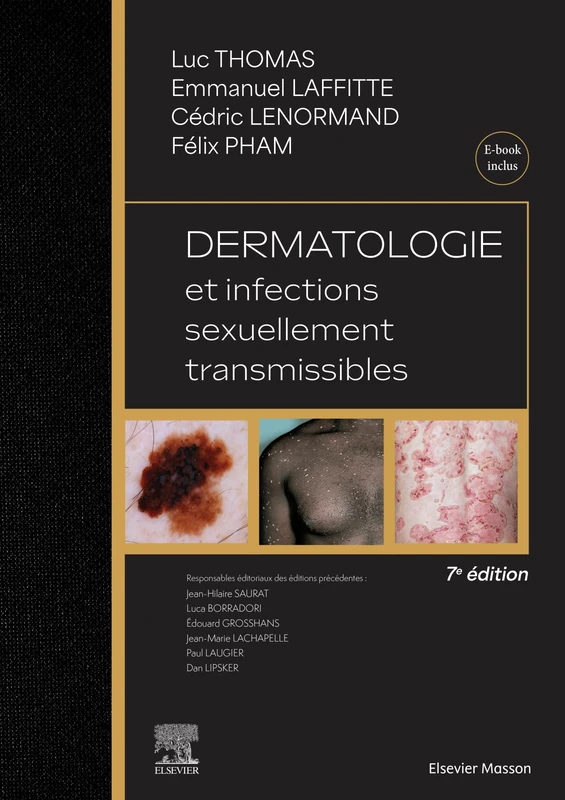 Dermatologie et infections sexuellement transmissibles: Avec ebook