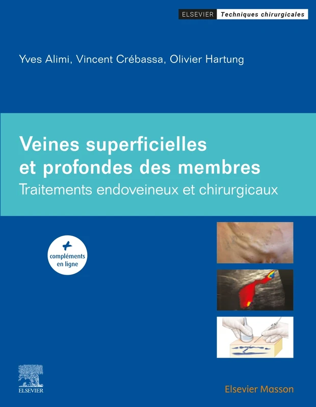 Veines superficielles et profondes des membres: Traitements endoveineux et chirurgicaux