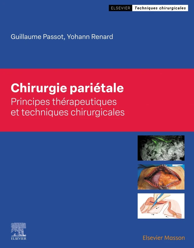 Elsevier Masson - Chirurgie Parietale - Medical Textbook