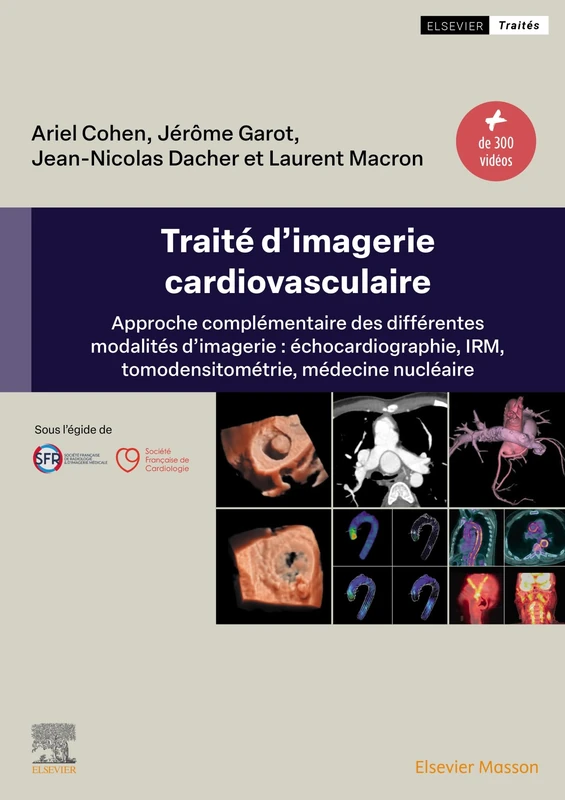 Elsevier Masson - Traite d'imagerie cardiovasculaire integre