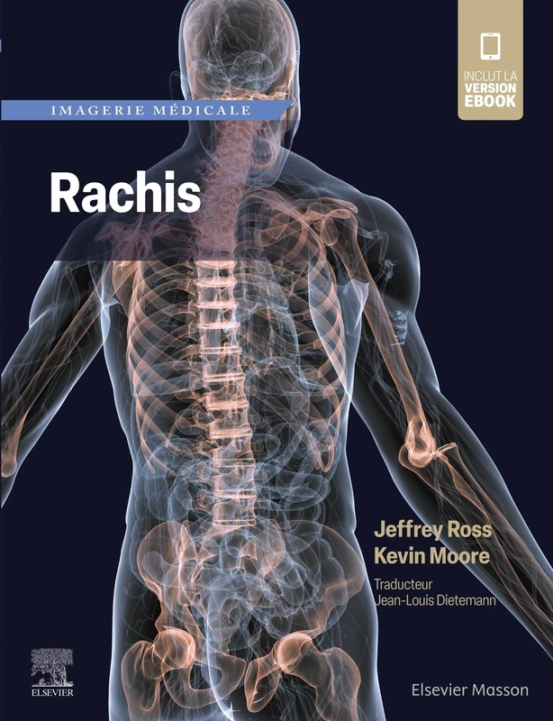 Imagerie médicale : Rachis - Image 1