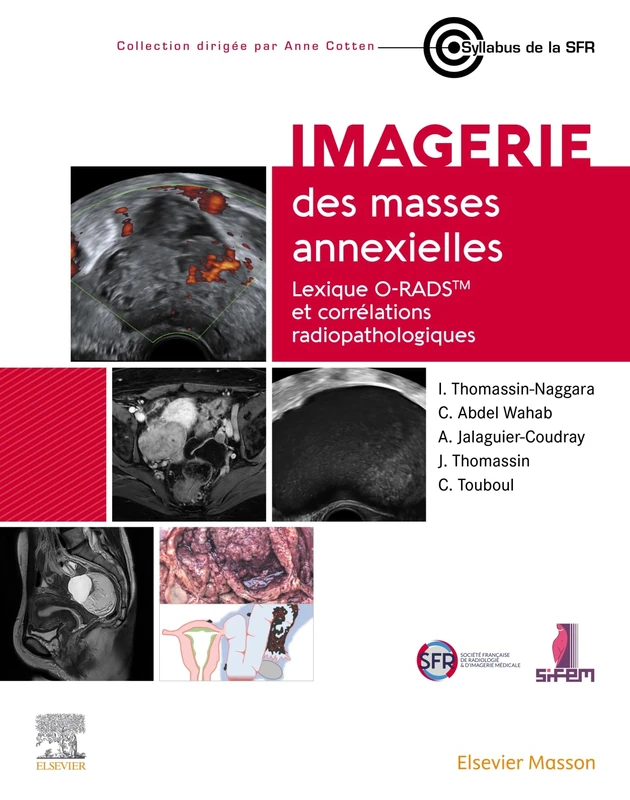 Imagerie des masses annexielles: Lexique O-RADS et corrélations radiopathologiques - Image 1